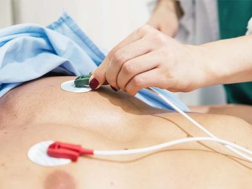 Kiểm Tra Sức Khỏe Tim Mạch – Nhanh Chóng, Chính Xác, An Toàn