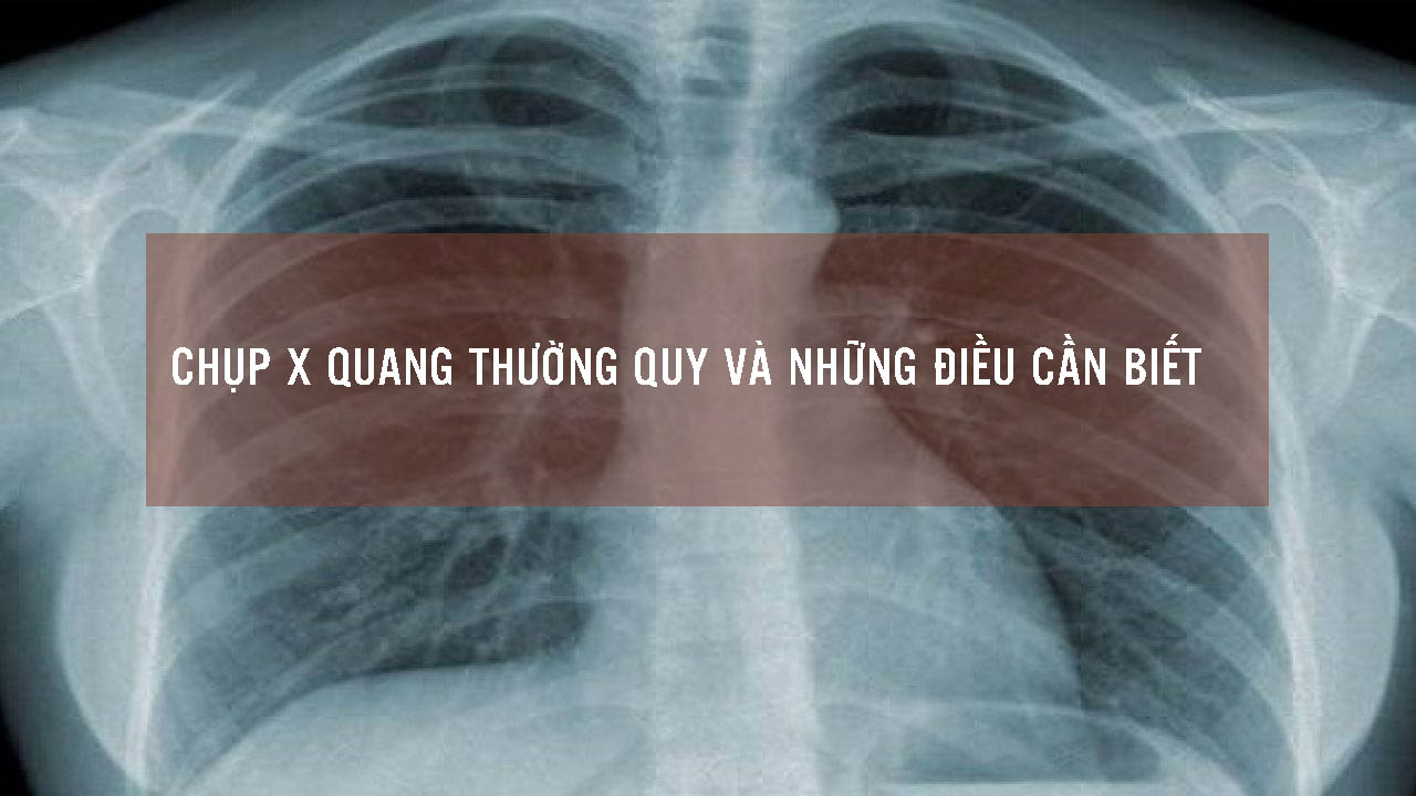 Lý do nên chọn dịch vụ chụp X-Quang thường quy tại Đà Nẵng