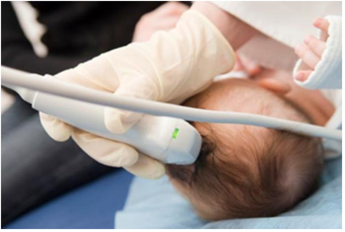 Tại sao phải siêu âm thóp sớm cho bé sơ sinh?